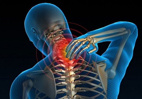 Боль в шее при остеохондрозе